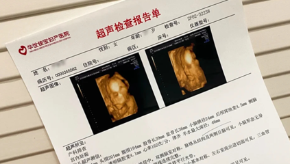 怀孕24周胎儿发育标准