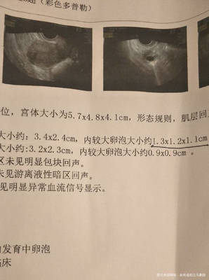 卵泡长不大会怀孕吗