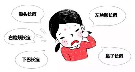 挤痘痘鼻子肿了