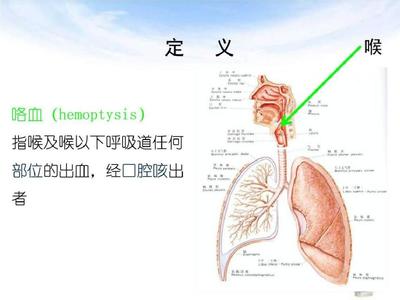 咽喉咳出血是怎么回事