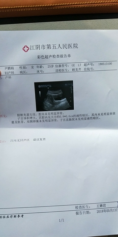 刚怀孕小腹会痛吗