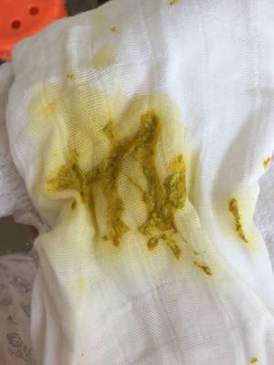 宝宝拉粑粑绿色
