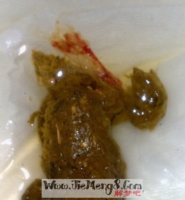周公解梦拉屎
