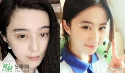 双眼皮有几种做法