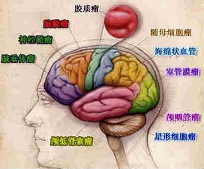 脑瘤怎么治疗