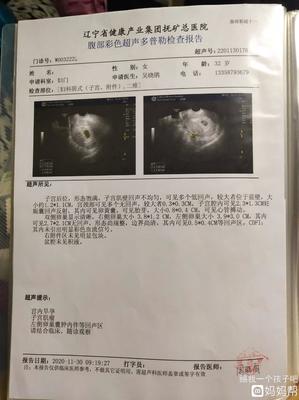 怀孕七周可以做人流吗
