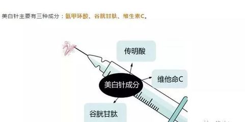 美白针的成份