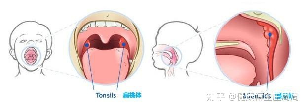 咳嗽有什么忌口