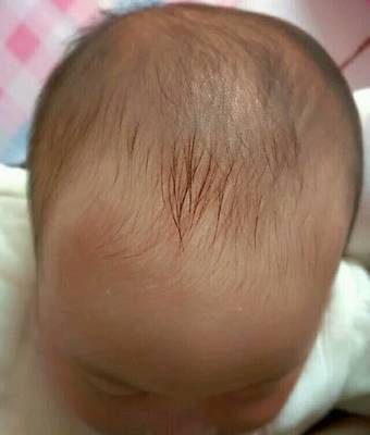婴儿几个月头定型