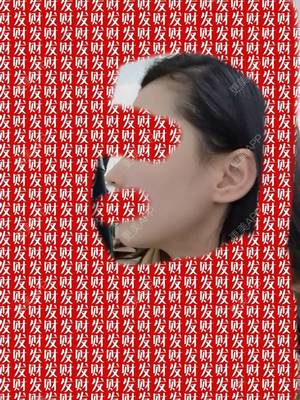 热水器旁边漏水怎么办