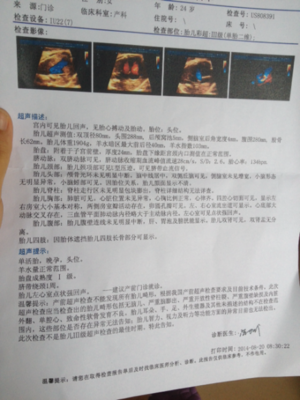 胎儿32周脐带绕颈一周怎么办