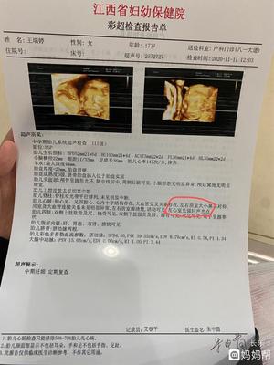江西省妇幼保健院彩超多少钱