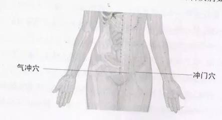 腹股沟炎症怎么治疗