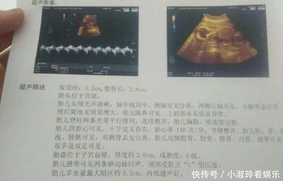胎儿几个月有胎动正常