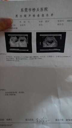 怀孕有宫腔积液