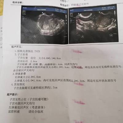 怀孕生化怎么办