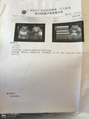 怎么看怀孕没