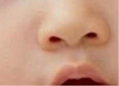 宝宝两个月鼻塞怎么办