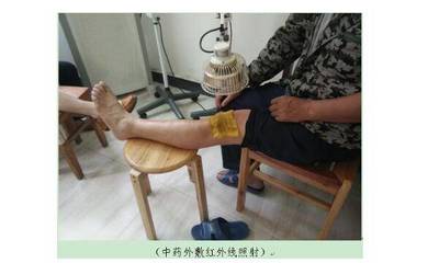 滑膜炎怎么治疗效果好