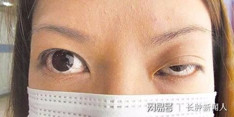 右眼皮抽搐是怎么回事