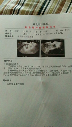 卵巢包块是怎么回事