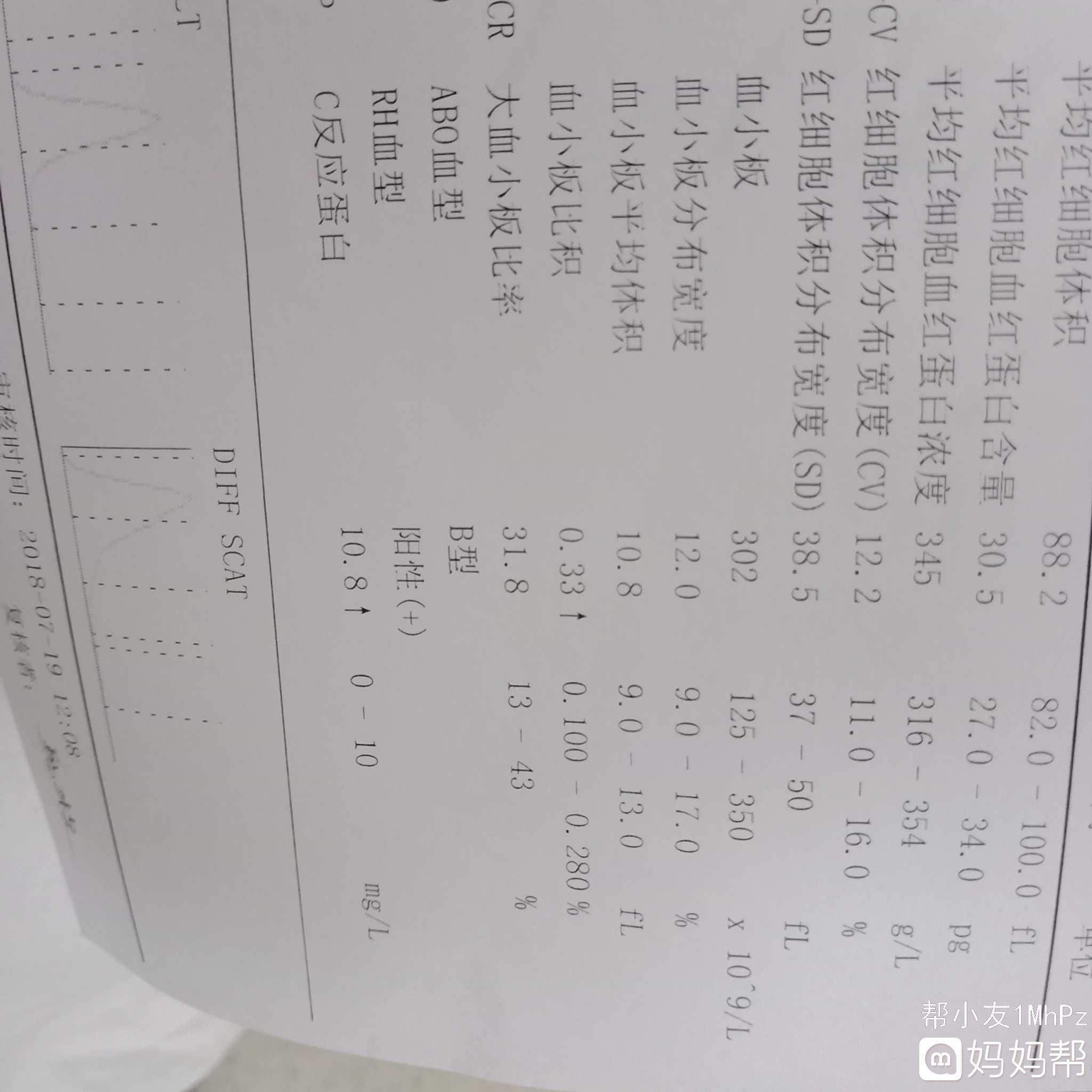 胎儿sd值偏高怎么回事