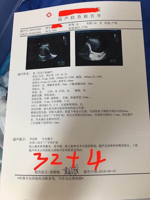 孕妇宫颈长度