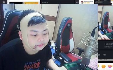 初中生男孩脸上长痘痘怎么治疗