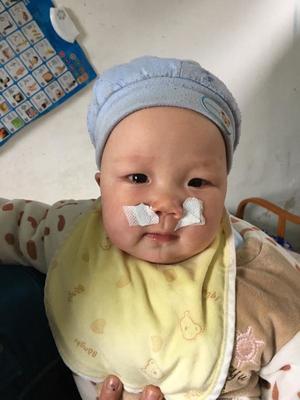 宝宝两个月鼻塞怎么办