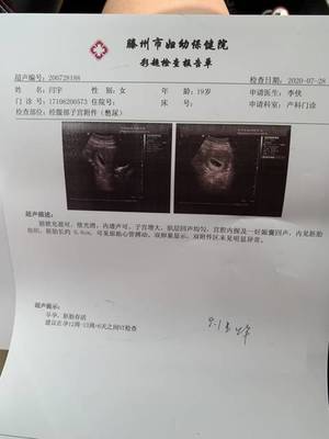 怎么确定是不是怀孕了