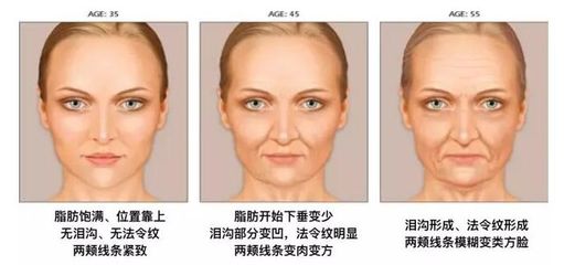 法令纹是哪个部位
