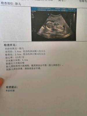 18周胎儿真实图