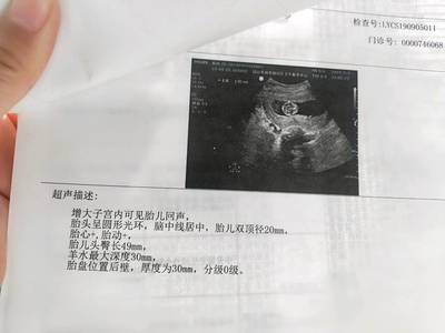 四个月胎动