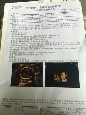 22周是几个月
