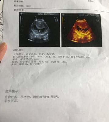 四个月胎动