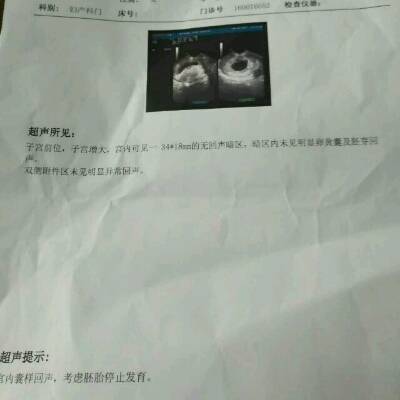 怀孕两个月宝宝多大