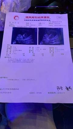 怀孕十一周胎儿会动吗