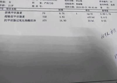 促甲状腺素高是怎么回事