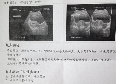 怀孕四十天什么症状