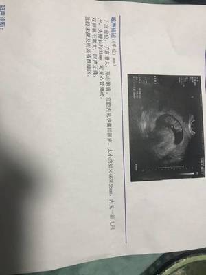 孕酮低胎儿发育正常
