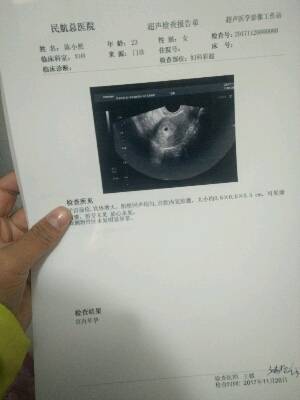 彩超 怀孕