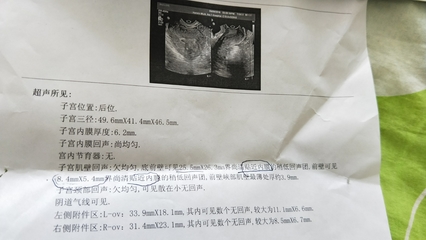 过几天能查出是否怀孕