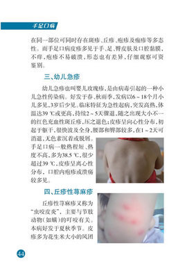 口腔黏膜病怎么治疗