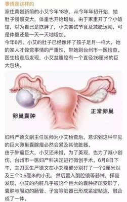 刚怀孕下面出血