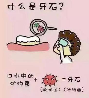 什么时候不能洗牙