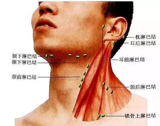 脖子两侧淋巴疼是怎么回事