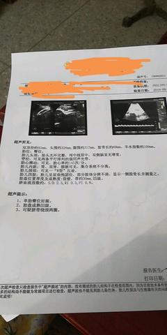 胎儿后期一周长多少斤