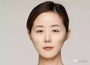 夫妻宫凹陷的女人面相