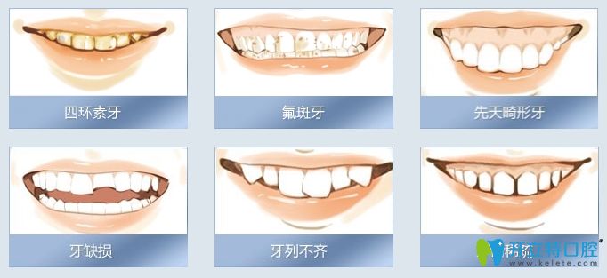钴铬合金烤瓷牙做核磁共振可以吗