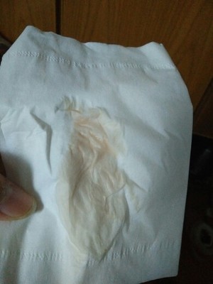 白带会怀孕吗